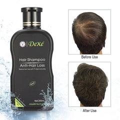 Dexe Anti-hair Loss Shampoo