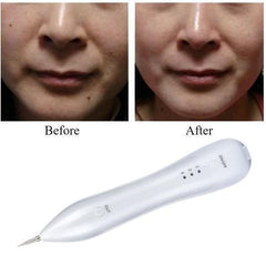 RemoveIt - Painless Mole & Dark Spot Removal