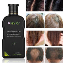 Dexe Anti-hair Loss Shampoo