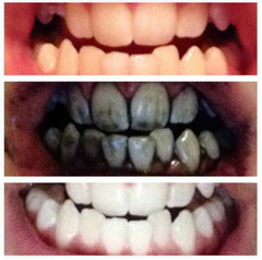 NATURAL BAMBOO CHARCOAL TEETH WHITENER TOOTHPASTE